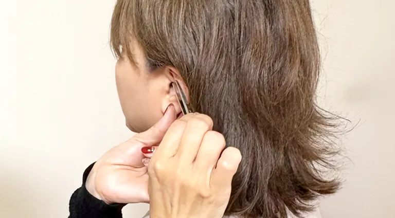 耳つぼ施術の模様